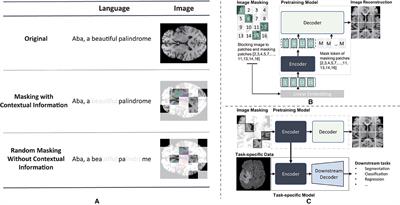 Improving brain tumor segmentation with anatomical prior-informed pre-training